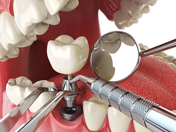 Best Emergency Tooth Extraction in Woodbury Heights, NJ